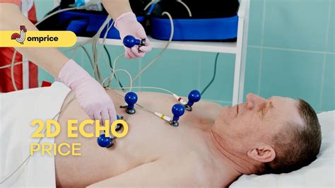 2d echo price list.